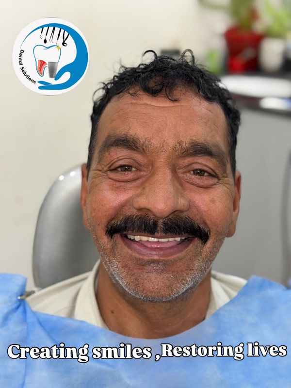 Patient smiling with his new fixed teeth