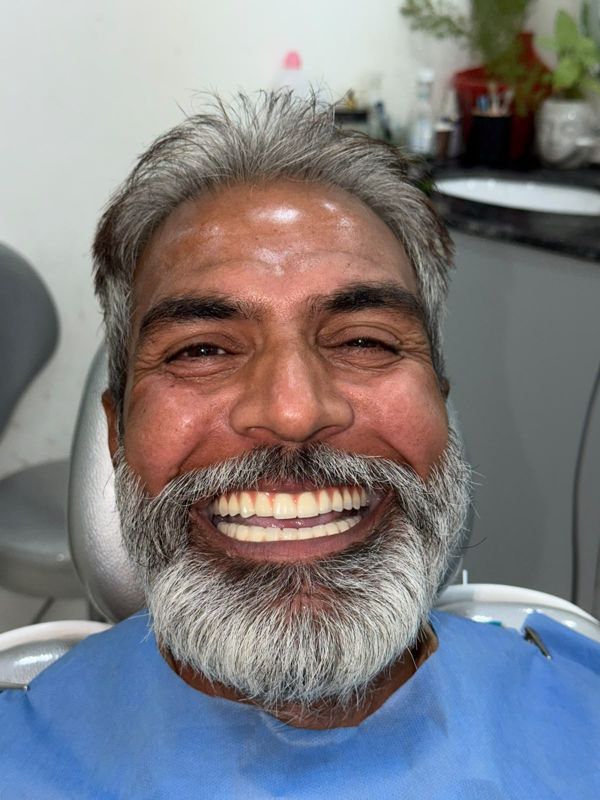 Patient smiling with full fixed implant teeth